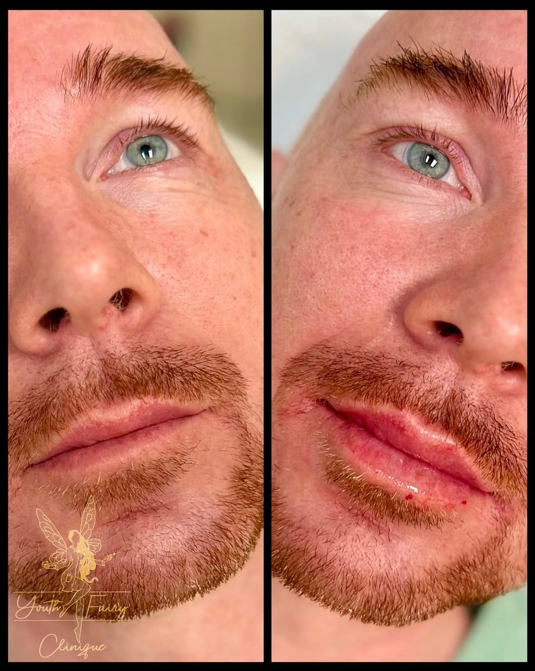 Post 1 by Blink Aesthetics on Instagram (carousel)