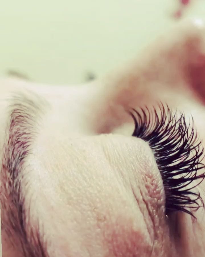Post 9 by Blink Aesthetics on Instagram (video)