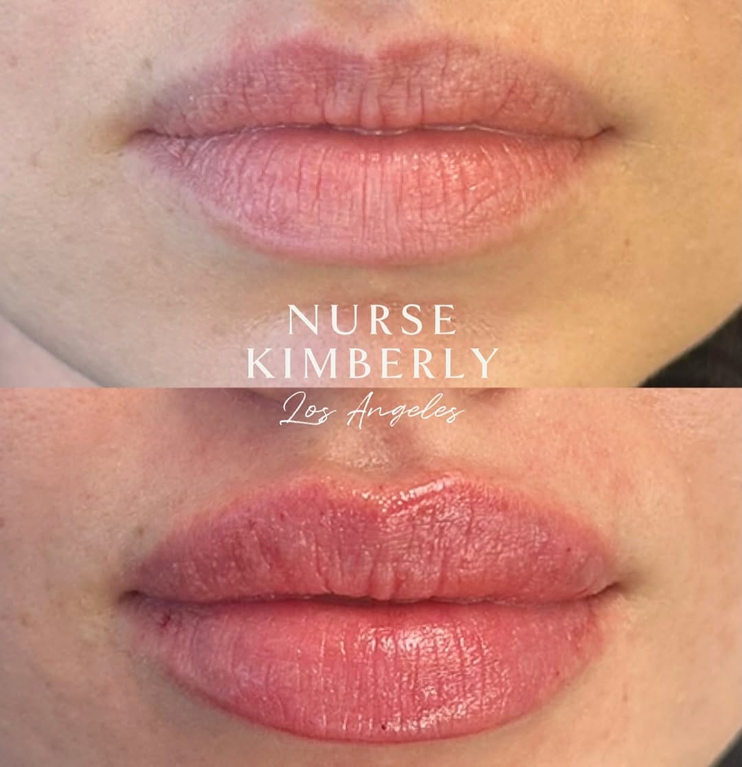 Post 3 by Kimberly Santos on Instagram (image)