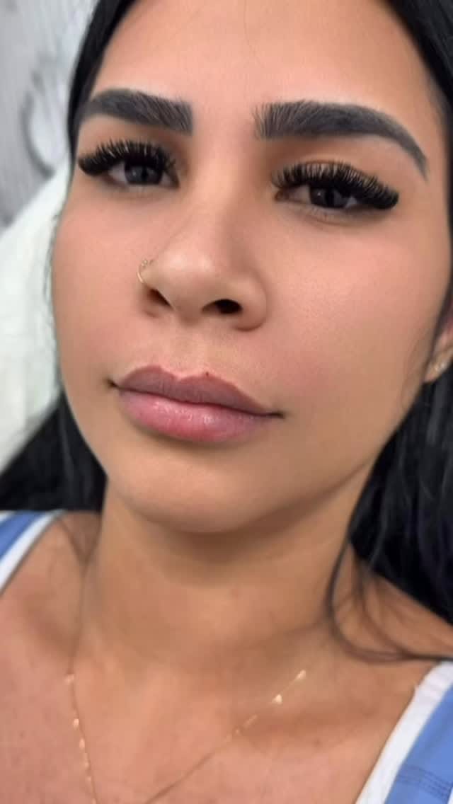 Post 4 by White Coat Medspa on Instagram (video)