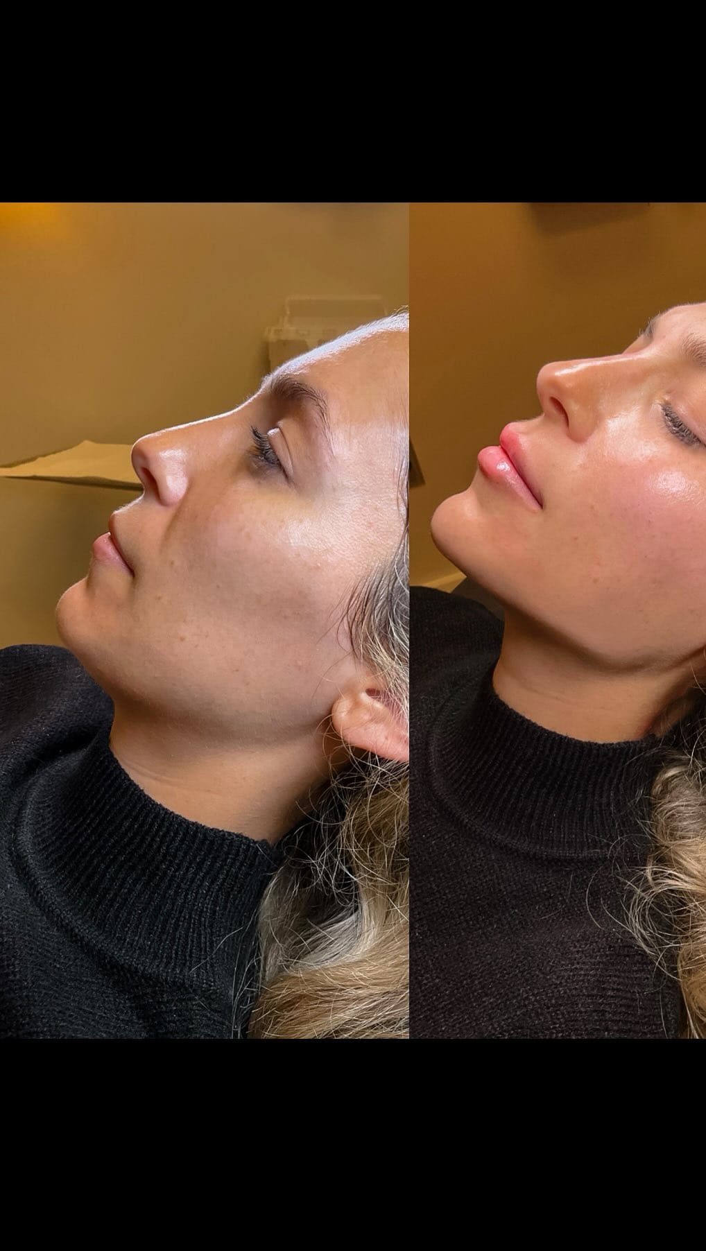 Post 8 by Shelby Injects 💉 on Instagram (video)
