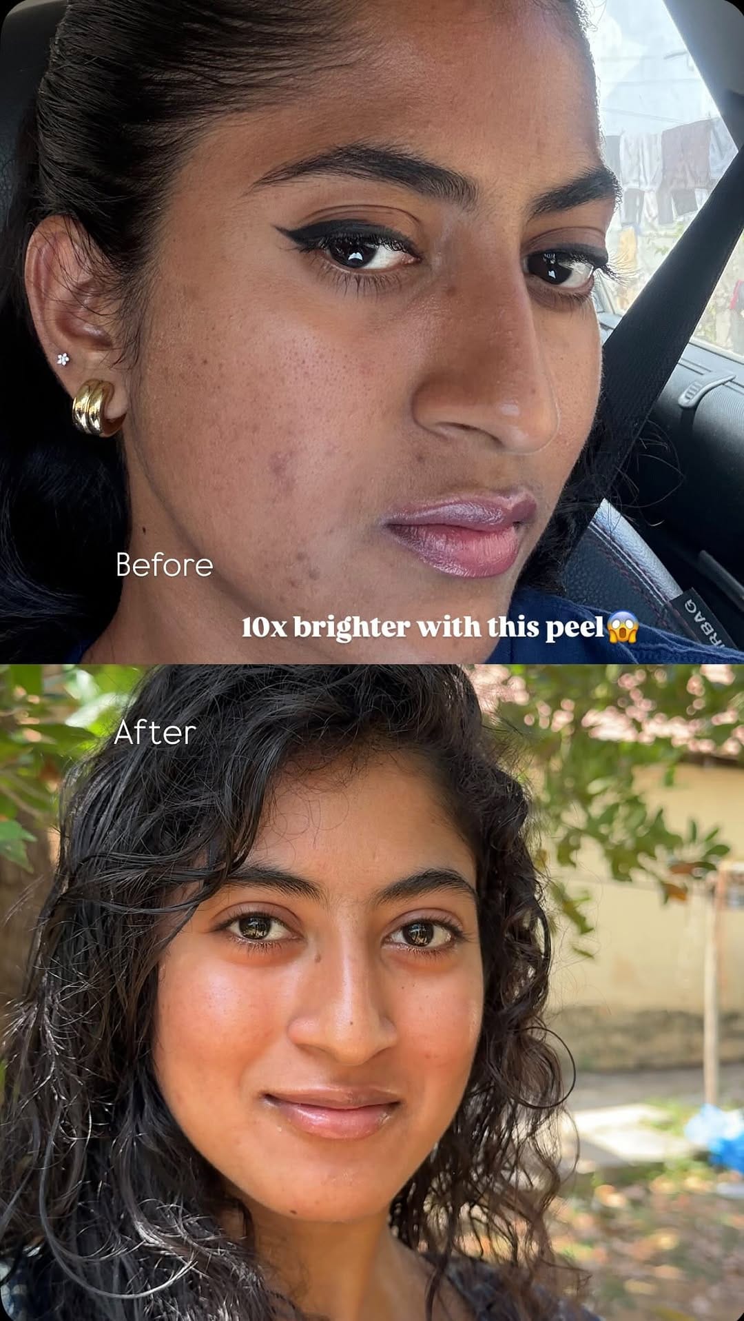 Post 8 by Maya Medi Spa India on Instagram (video)