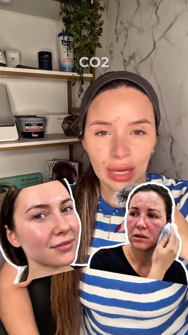 Post 1 by Carla Zabaleta | SkinHolics Miami on Instagram (video)