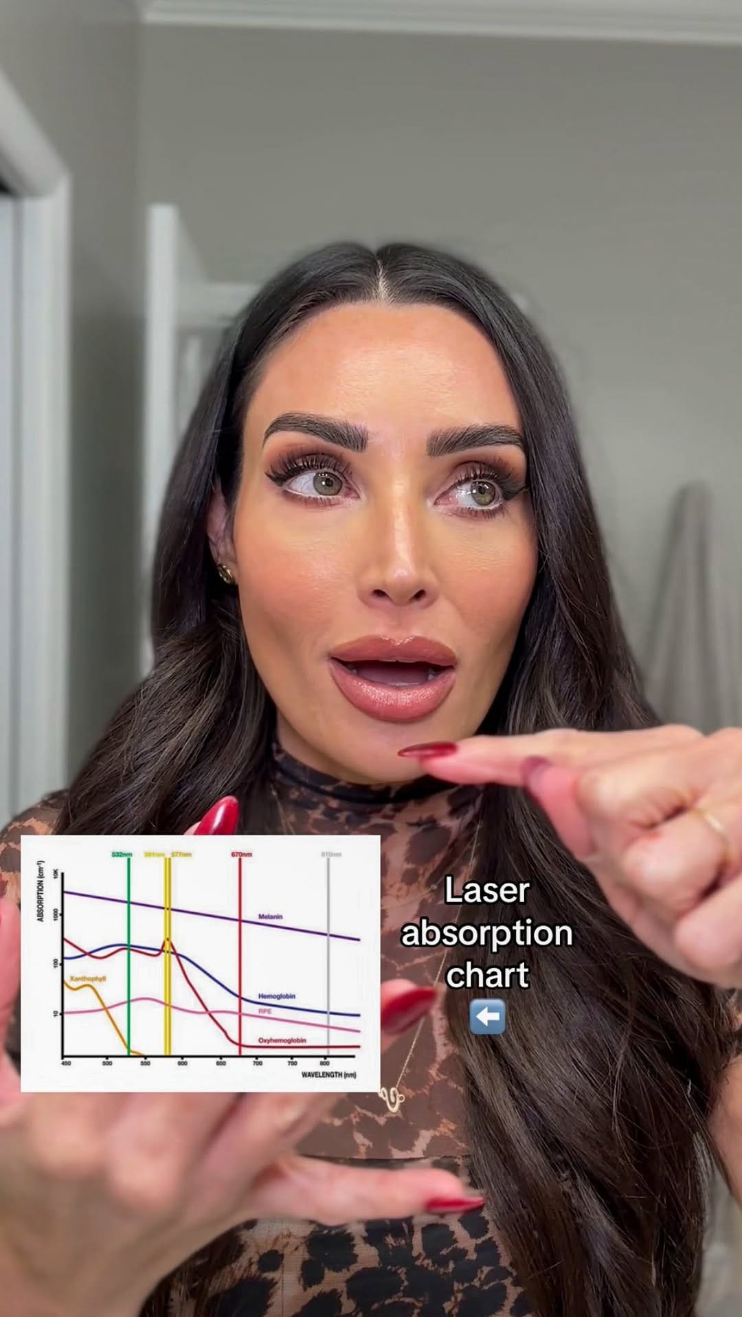 Post 8 by Caroline - Aesthetic Industry Pro on Instagram (video)