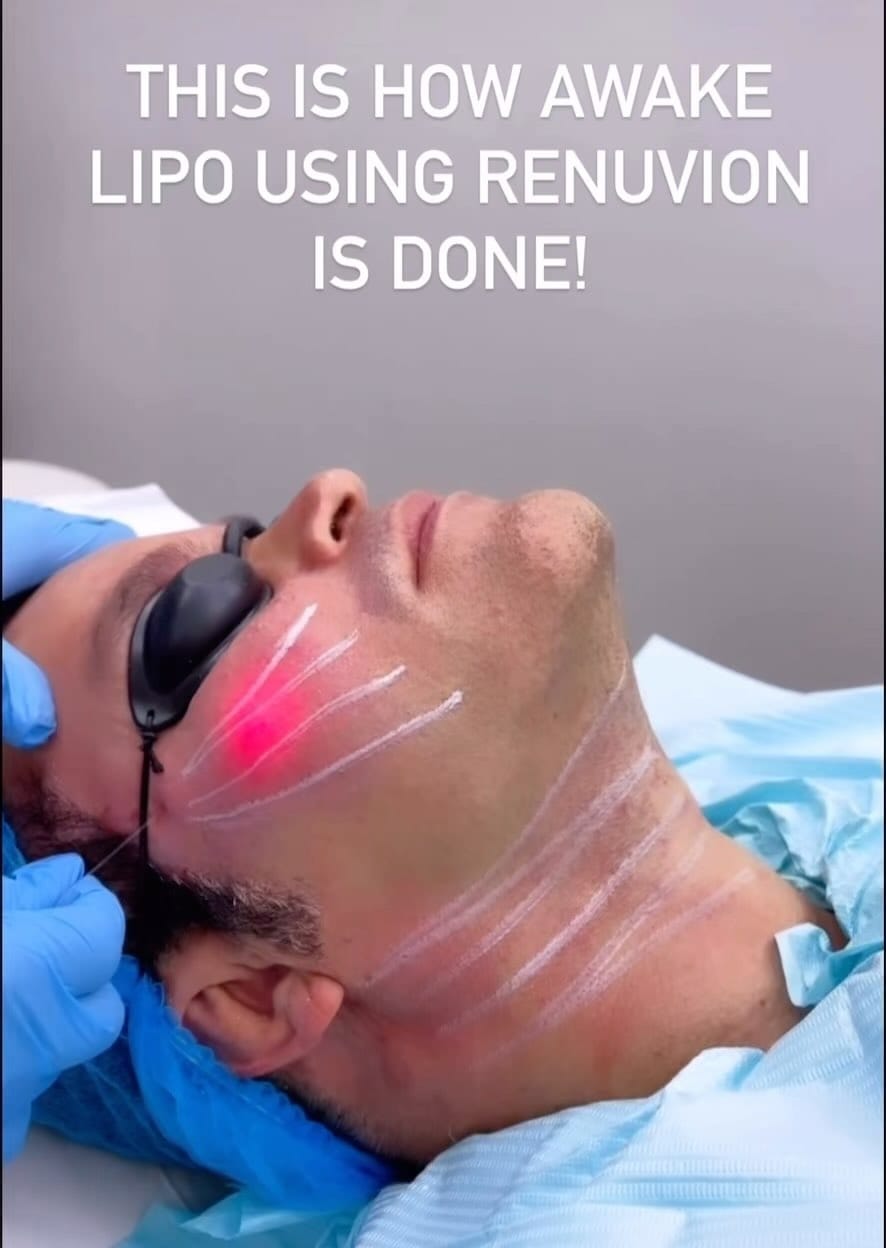 Post 1 by Beverlyhills Aesthetic on Instagram (video)