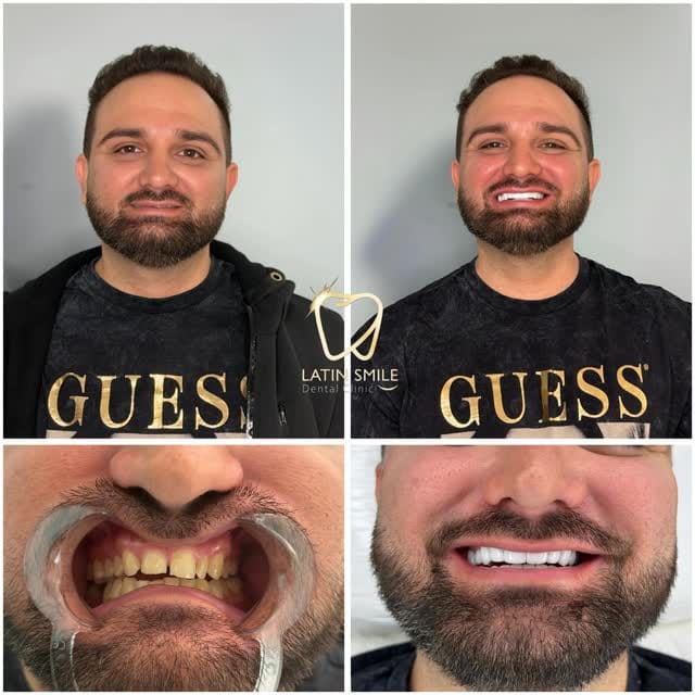 Post 1 by Latin Smile Dental Clinic on Instagram (video)