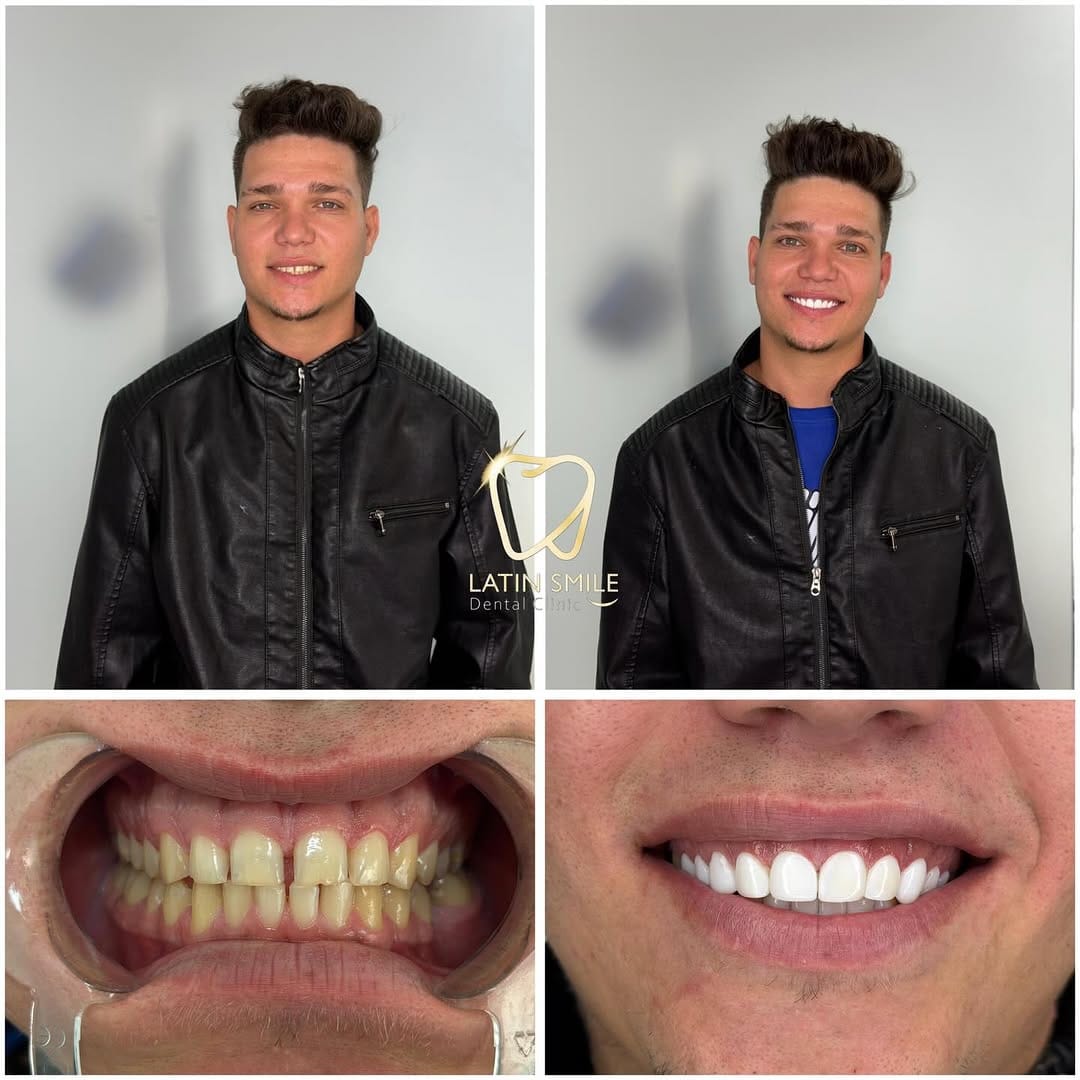 Post 2 by Latin Smile Dental Clinic on Instagram (image)