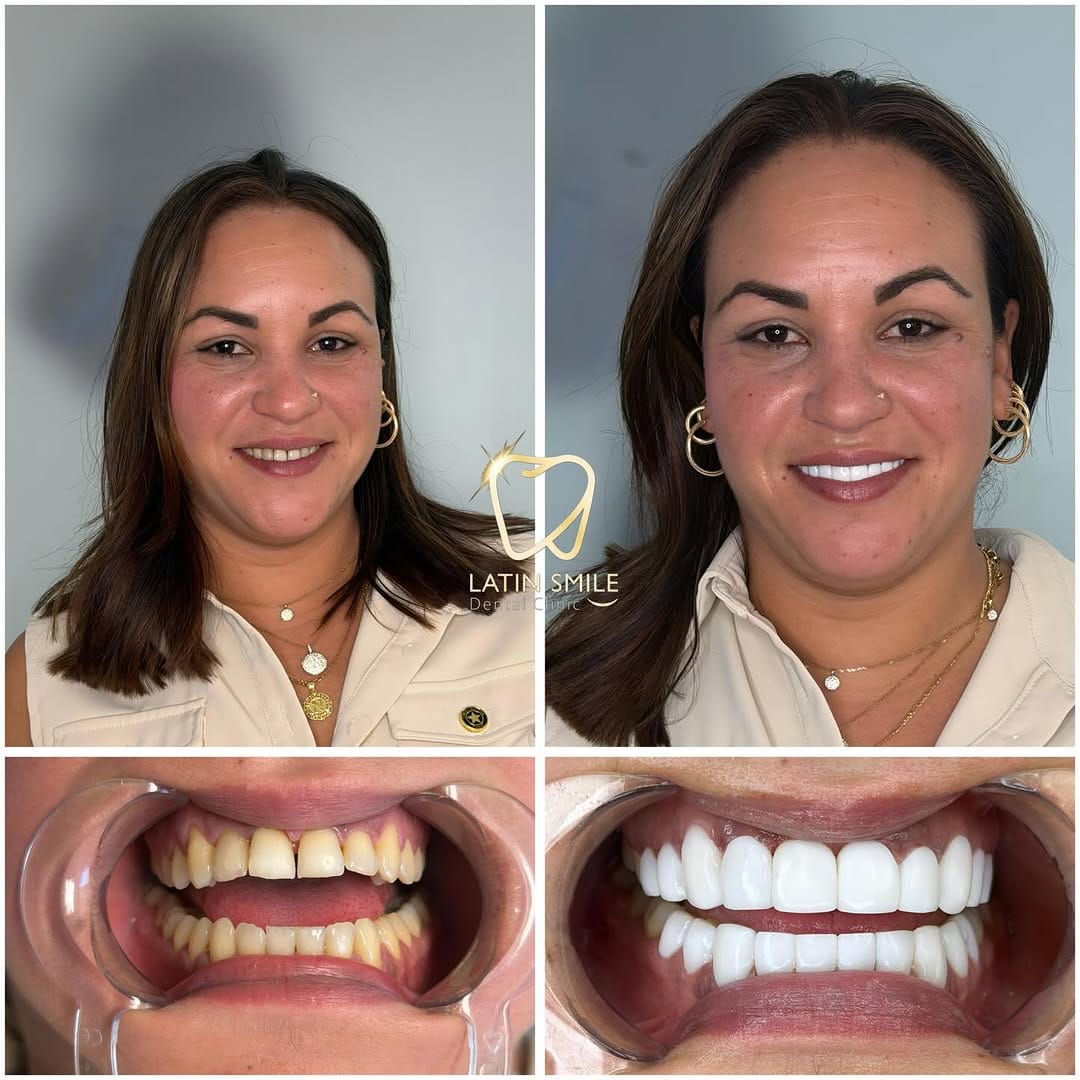 Post 6 by Latin Smile Dental Clinic on Instagram (image)