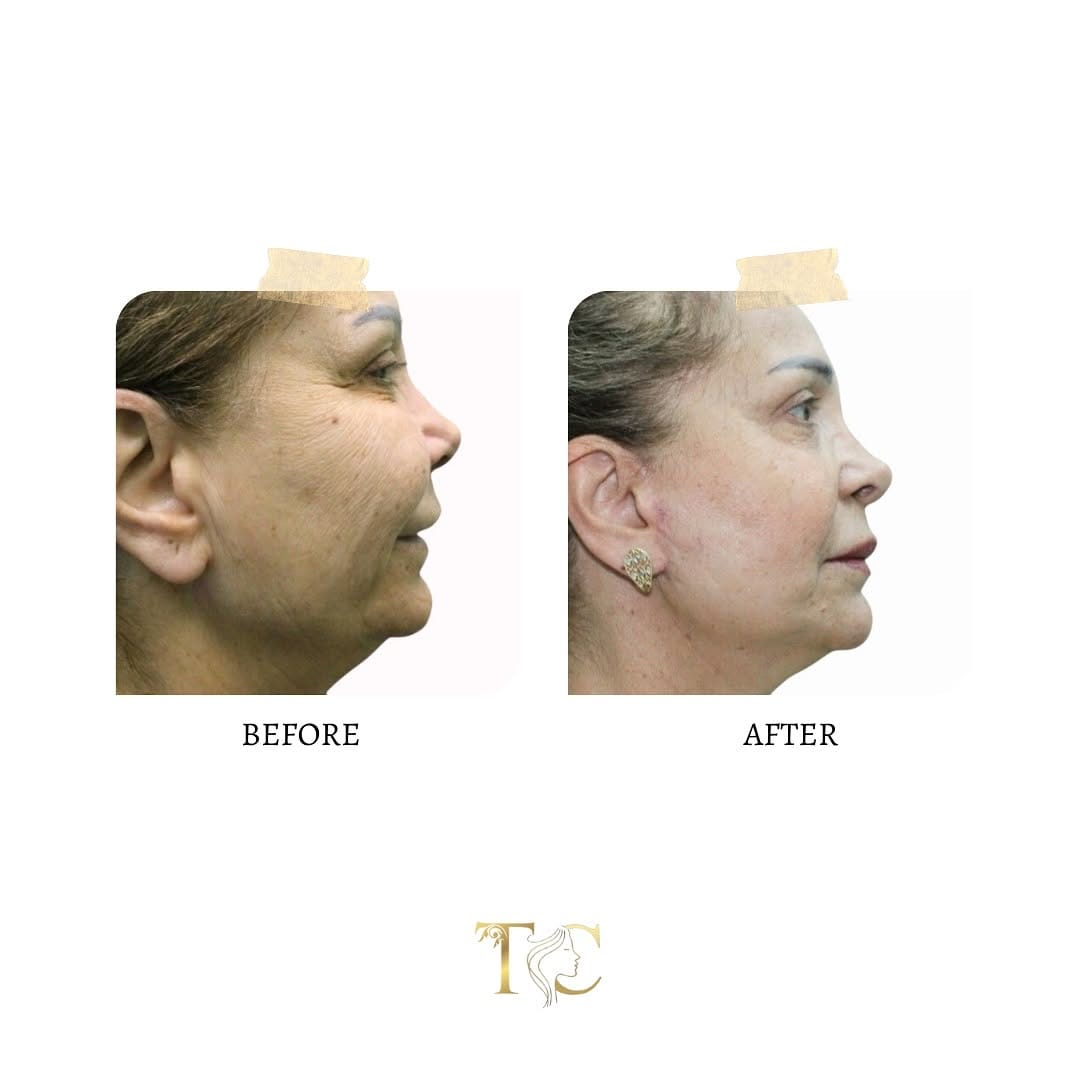 Post 8 by Dr. Hussein Altarawneh | دكتور حسين الطراونة on Instagram (image)