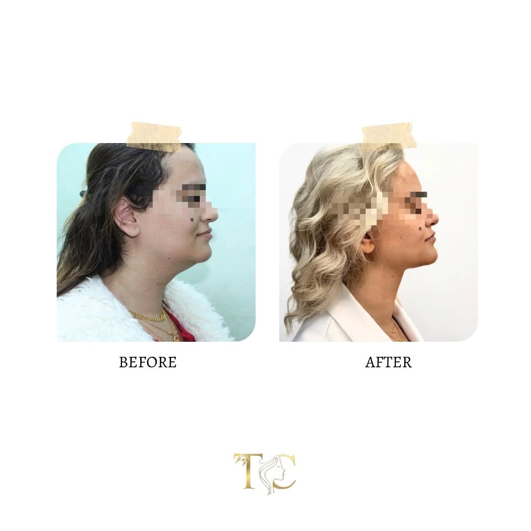 Post 5 by Dr. Hussein Altarawneh | دكتور حسين الطراونة on Instagram (image)