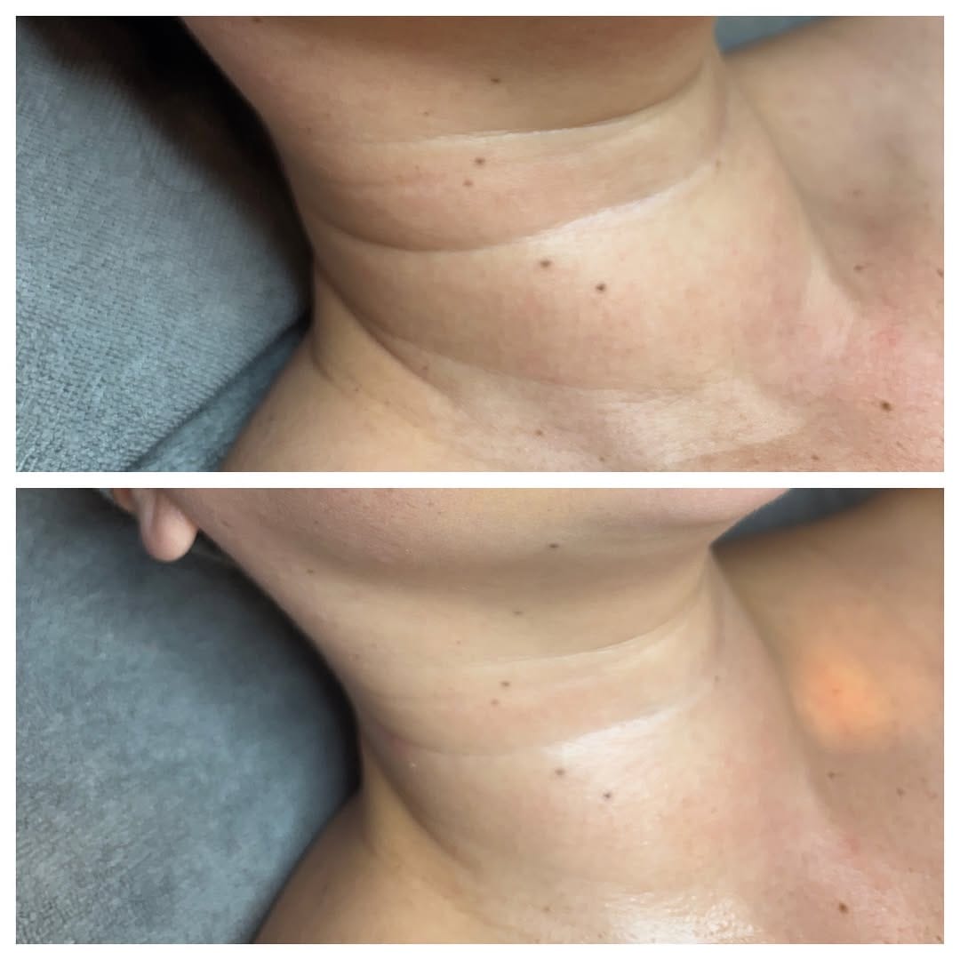 Post 2 by Fernanda Heckman Licensed Medical Aesthetician | Nashville, TN on Instagram (carousel)