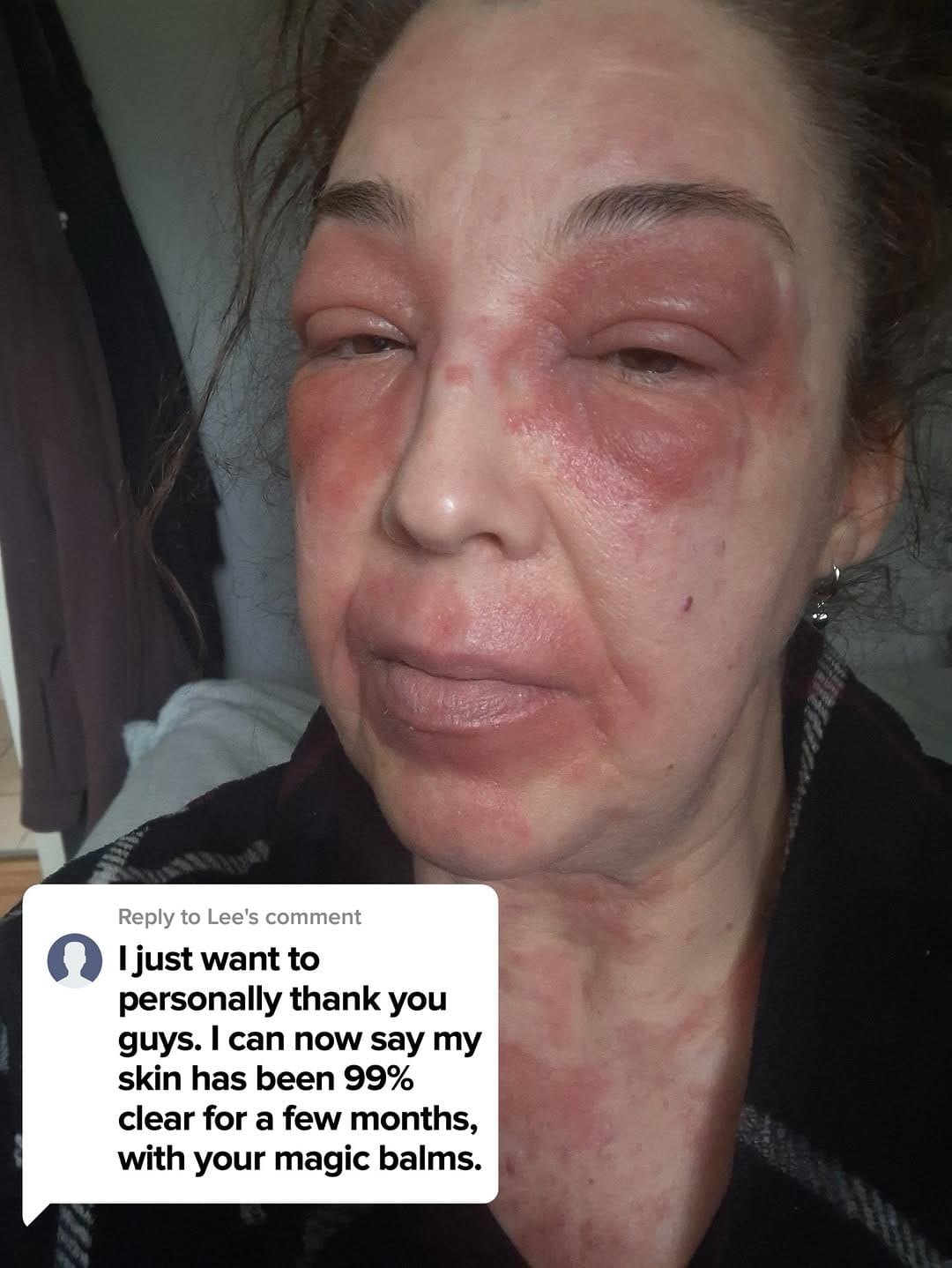 Post 9 by Thunderbird Natural Skincare on Instagram (carousel)