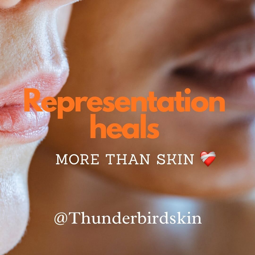 Post 8 by Thunderbird Natural Skincare on Instagram (carousel)