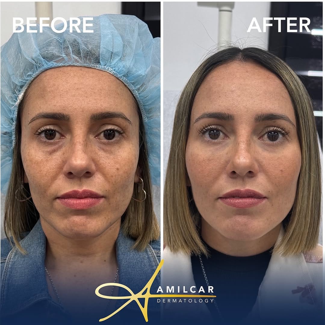 Post 10 by Amílcar G. Rodríguez,MD,FAAD on Instagram (carousel)