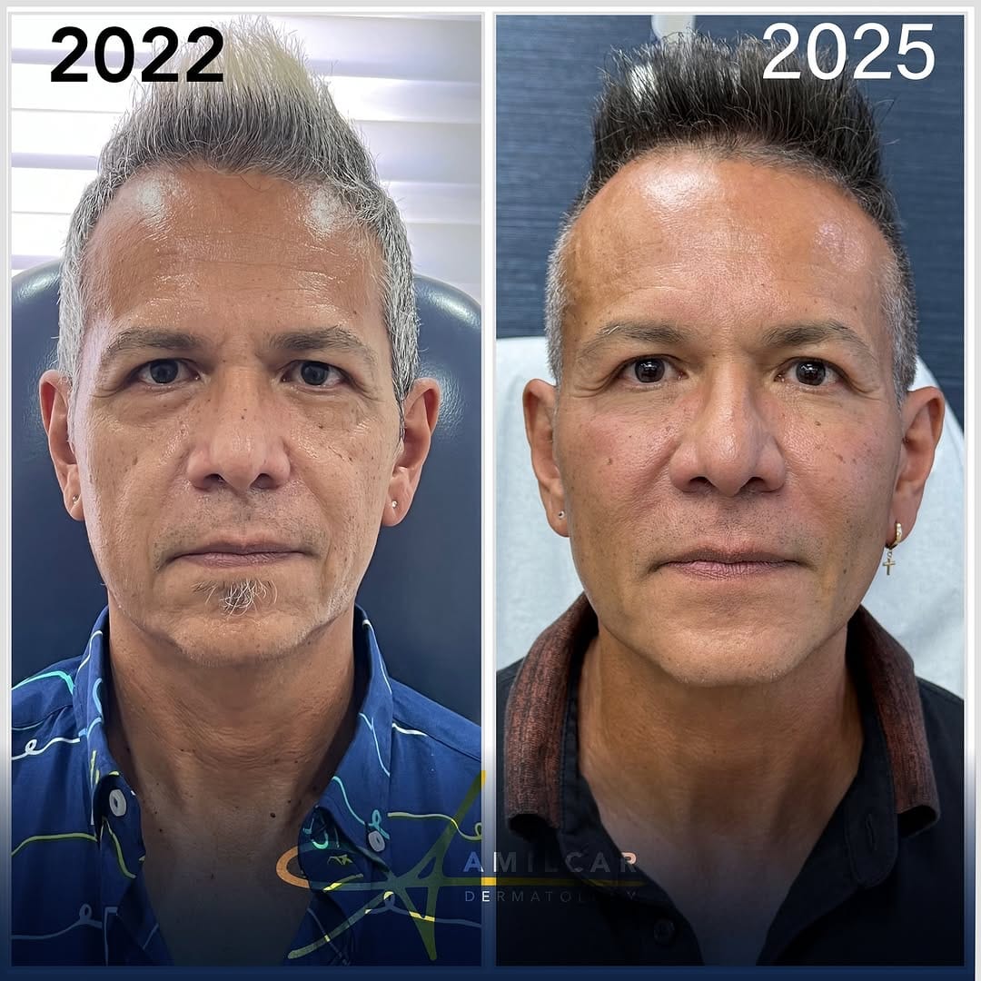 Post 2 by Amílcar G. Rodríguez,MD,FAAD on Instagram (carousel)