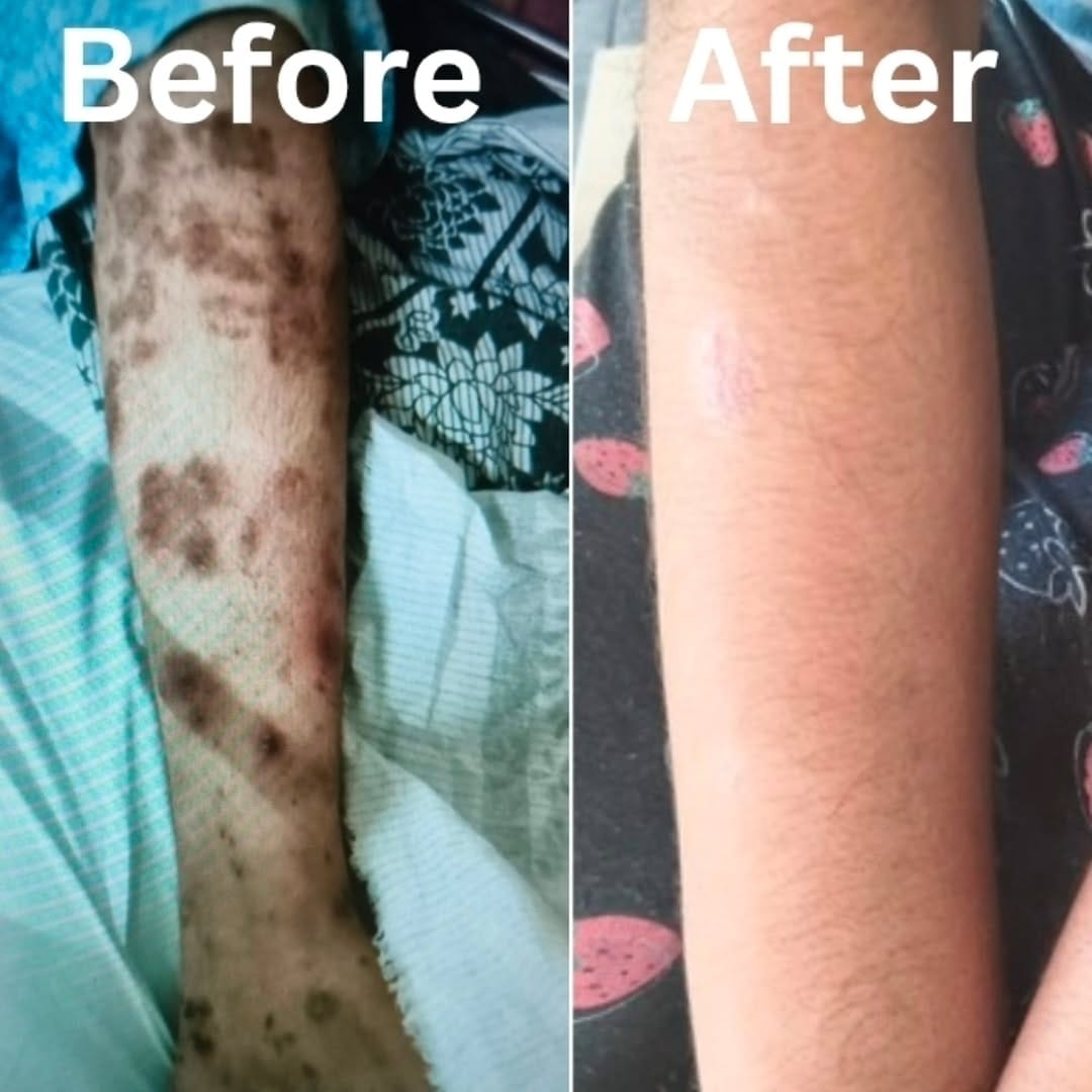 Post 9 by Dr.Bibin Jose on Instagram (image)