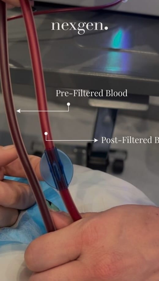 Post 7 by NexGen Health IV Therapy | San Jose, CA on Instagram (video)