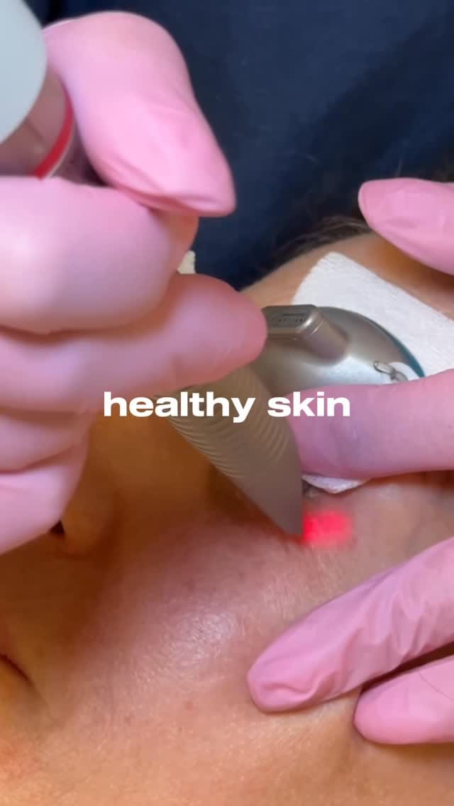 Post 4 by Azza Halim, M.D. on Instagram (video)