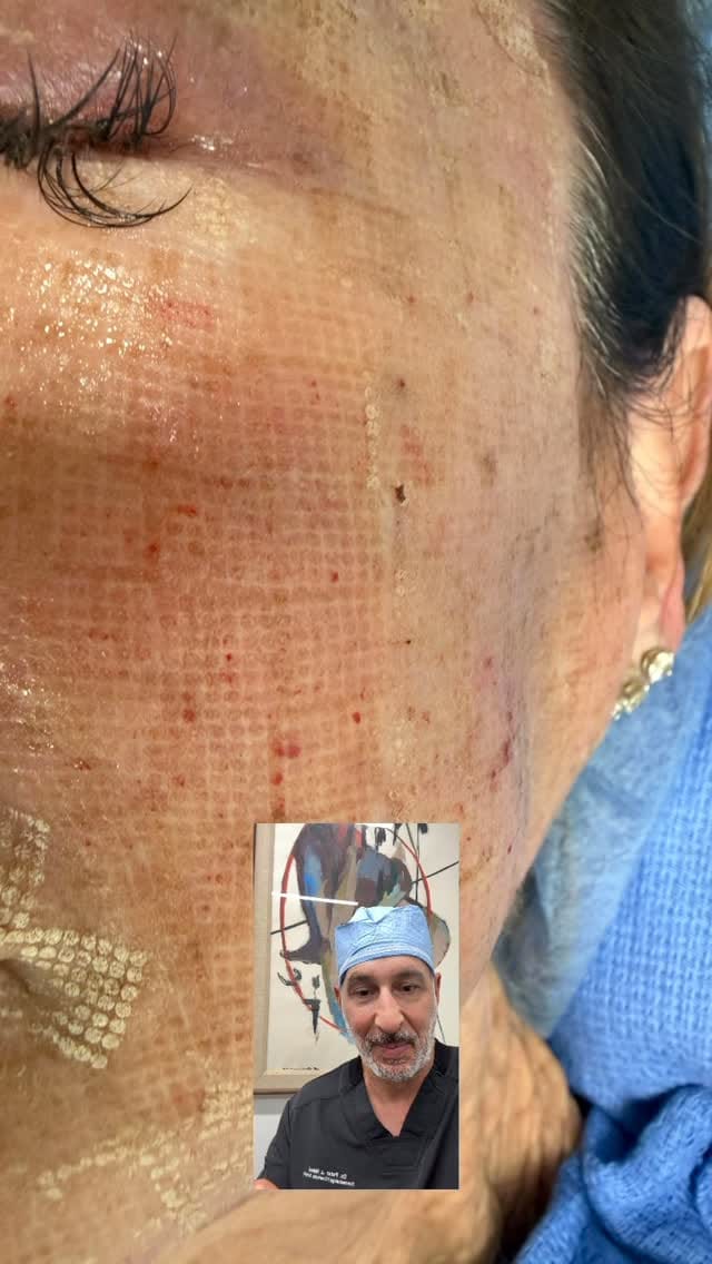 Post 4 by Dr.Peter Malouf on Instagram (video)