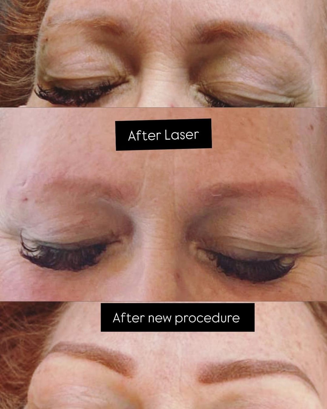 Post 3 by School of PMU Laser and Esthetics (Texas) on Instagram (image)