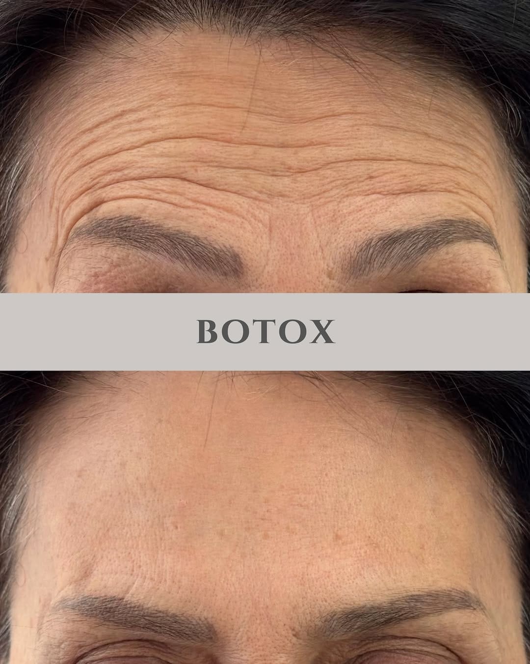 Post 3 by Ani Vardanyan | RN,  AESTHETIC INJECTOR on Instagram (carousel)