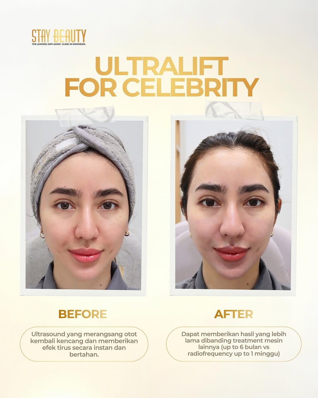 Post 7 by Stay Beauty - The Leading Antiaging Clinic in Indonesia on Instagram (image)