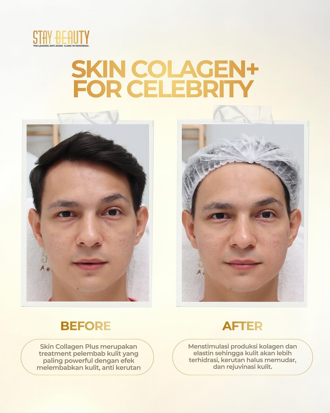 Post 8 by Stay Beauty - The Leading Antiaging Clinic in Indonesia on Instagram (image)