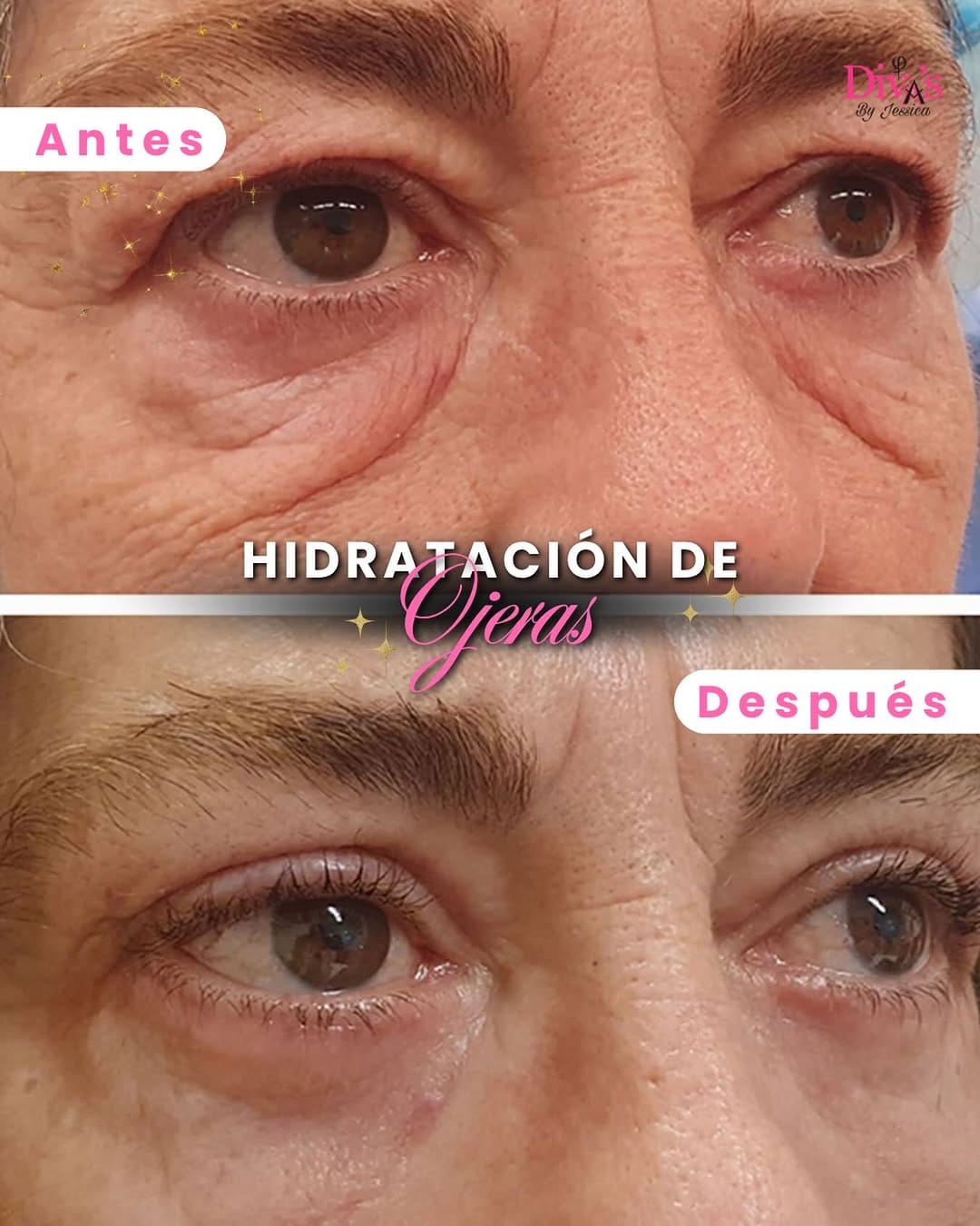 Post 8 by Jessica sarmiento | Micropigmentación • Cursos on Instagram (image)