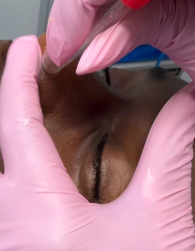 Post 3 by ATLANTA MEDICAL AESTHETICIAN | Jamesa on Instagram (video)