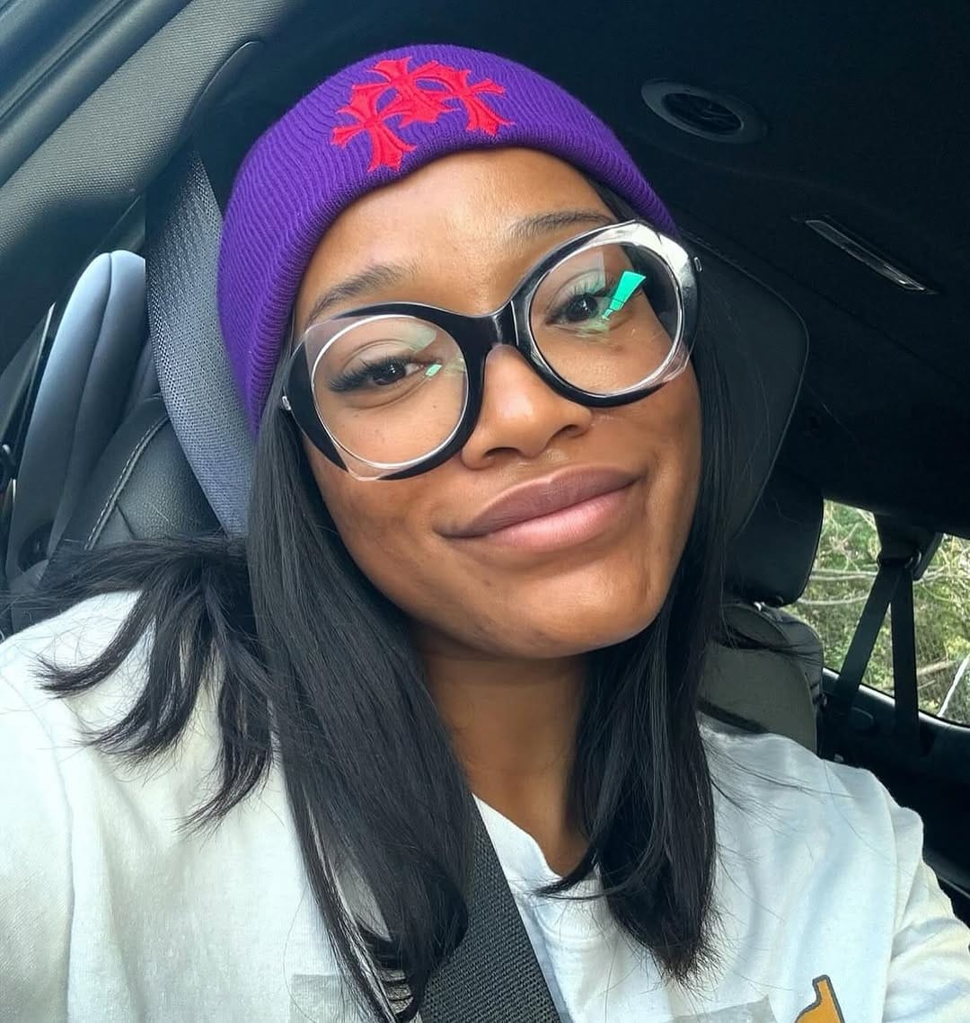 Post 9 by ATLANTA MEDICAL AESTHETICIAN | Jamesa on Instagram (image)