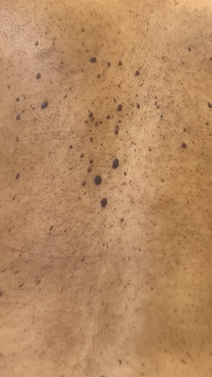 Post 8 by ATLANTA MEDICAL AESTHETICIAN | Jamesa on Instagram (video)