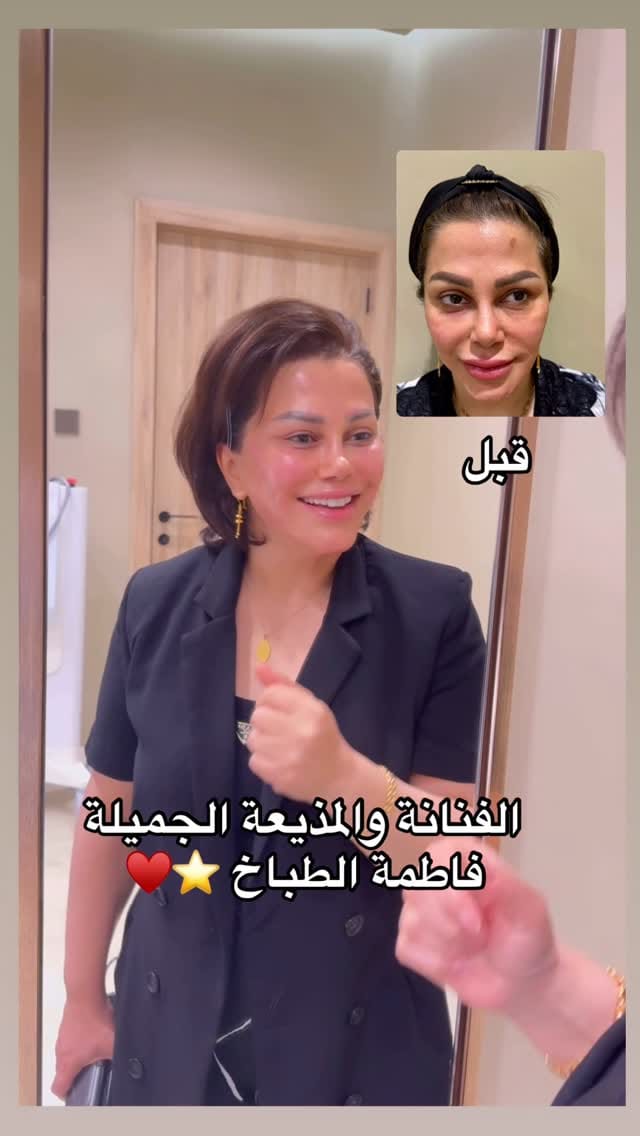 Post 8 by آلاء الطوخى ALAA EL-TOUKHY on Instagram (video)