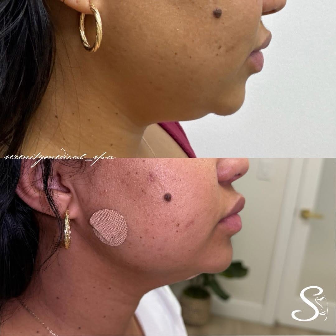 Post 2 by Dana Quiñones | Serenity Medical & Spa Center on Instagram (image)