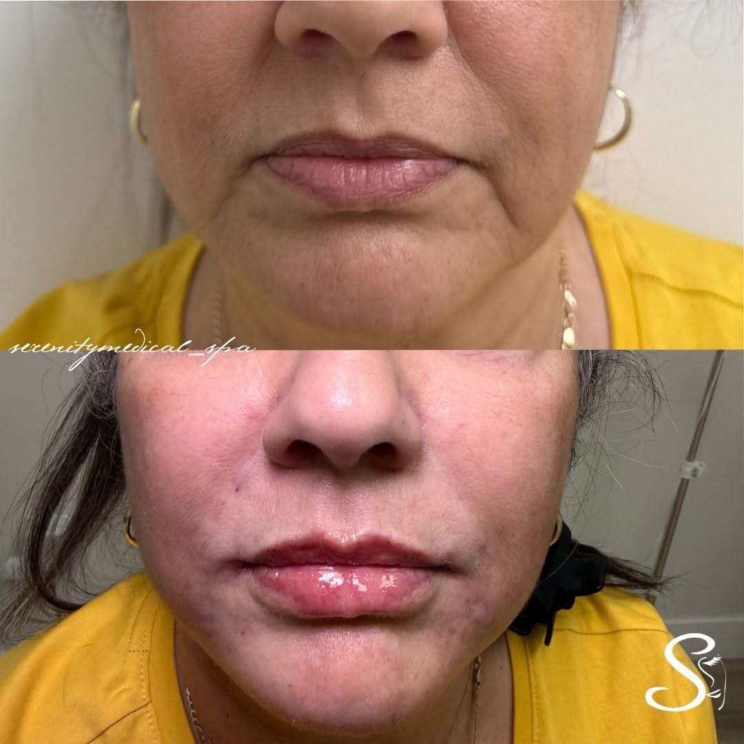 Post 8 by Dana Quiñones | Serenity Medical & Spa Center on Instagram (image)