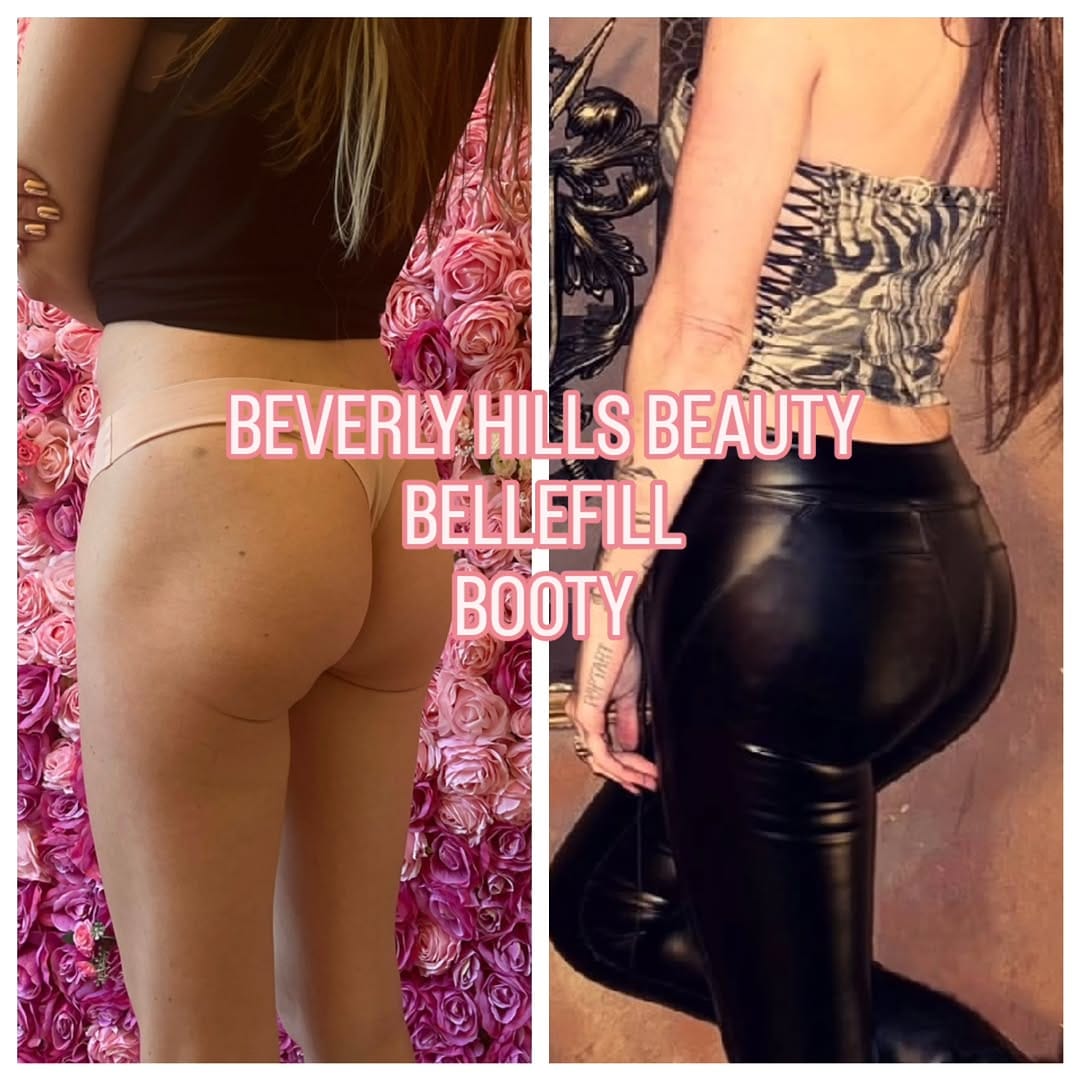 Post 3 by Beverly Hills Beauty & Aesthetics on Instagram (image)