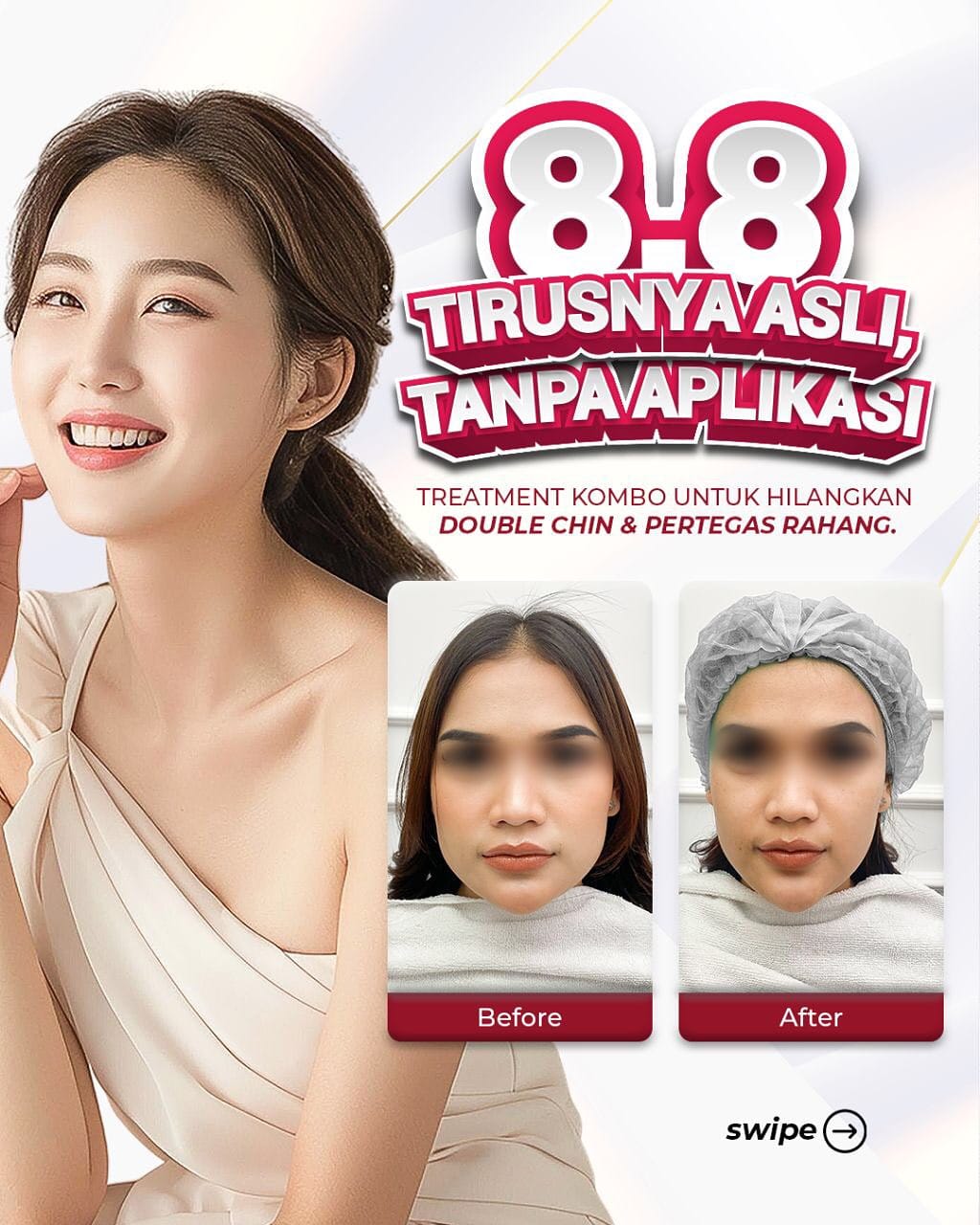 Post 4 by Klinik Inusa Babarsari on Instagram (carousel)