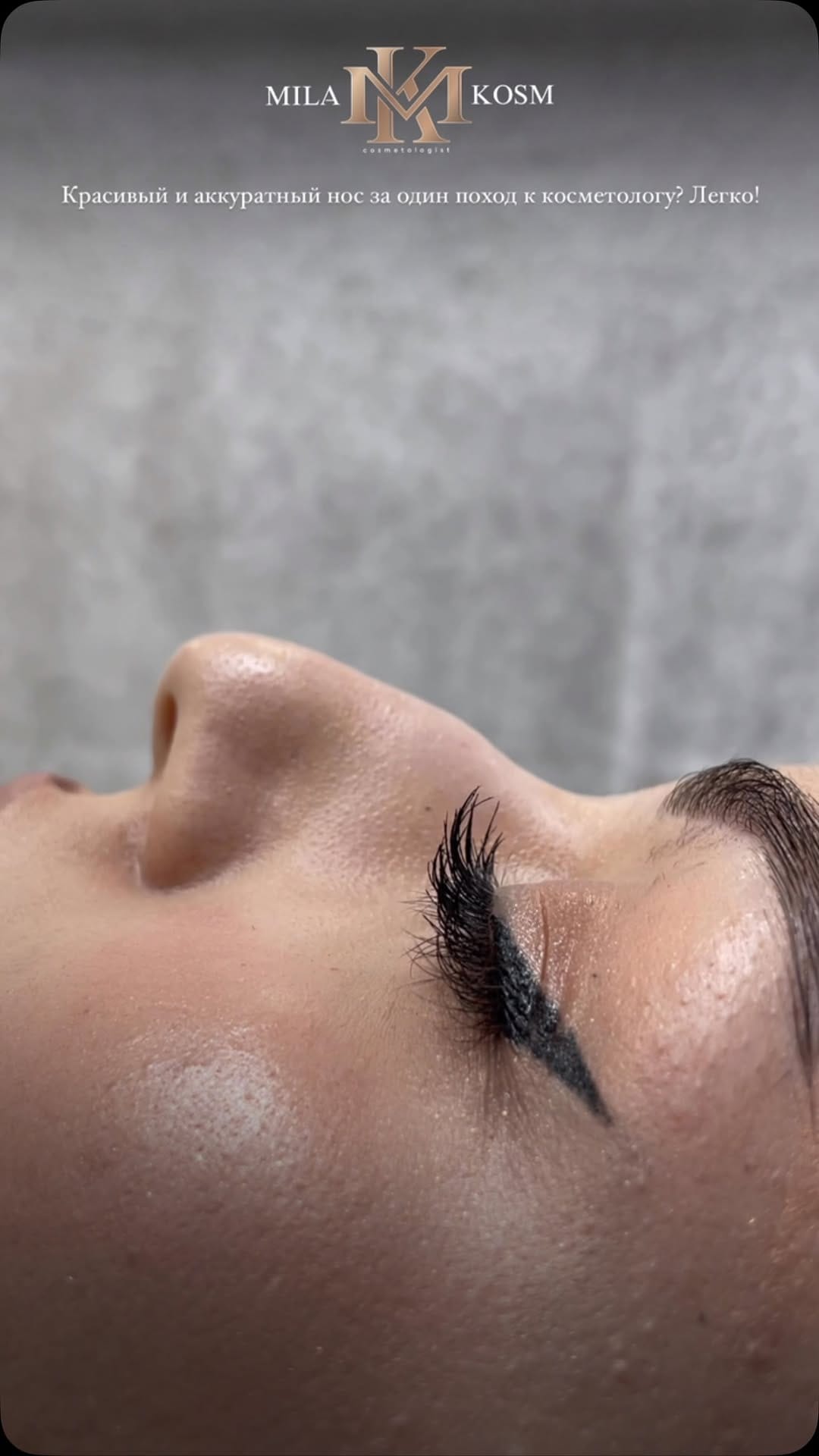 Post 7 by Dr. Mila 💉 work in USA 🇺🇸 Turkey 🇹🇷 Russia 🇷🇺 on Instagram (video)