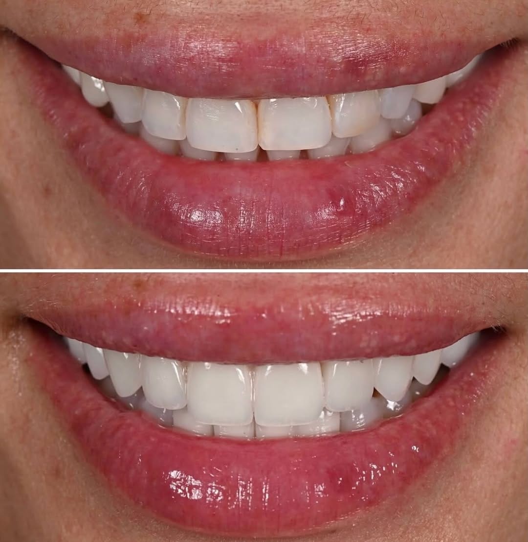 Post 2 by Apa Aesthetic on Instagram (image)