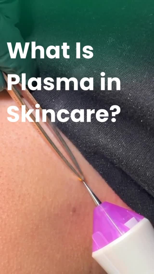 Post 4 by Glownar Aesthetics on Instagram (video)