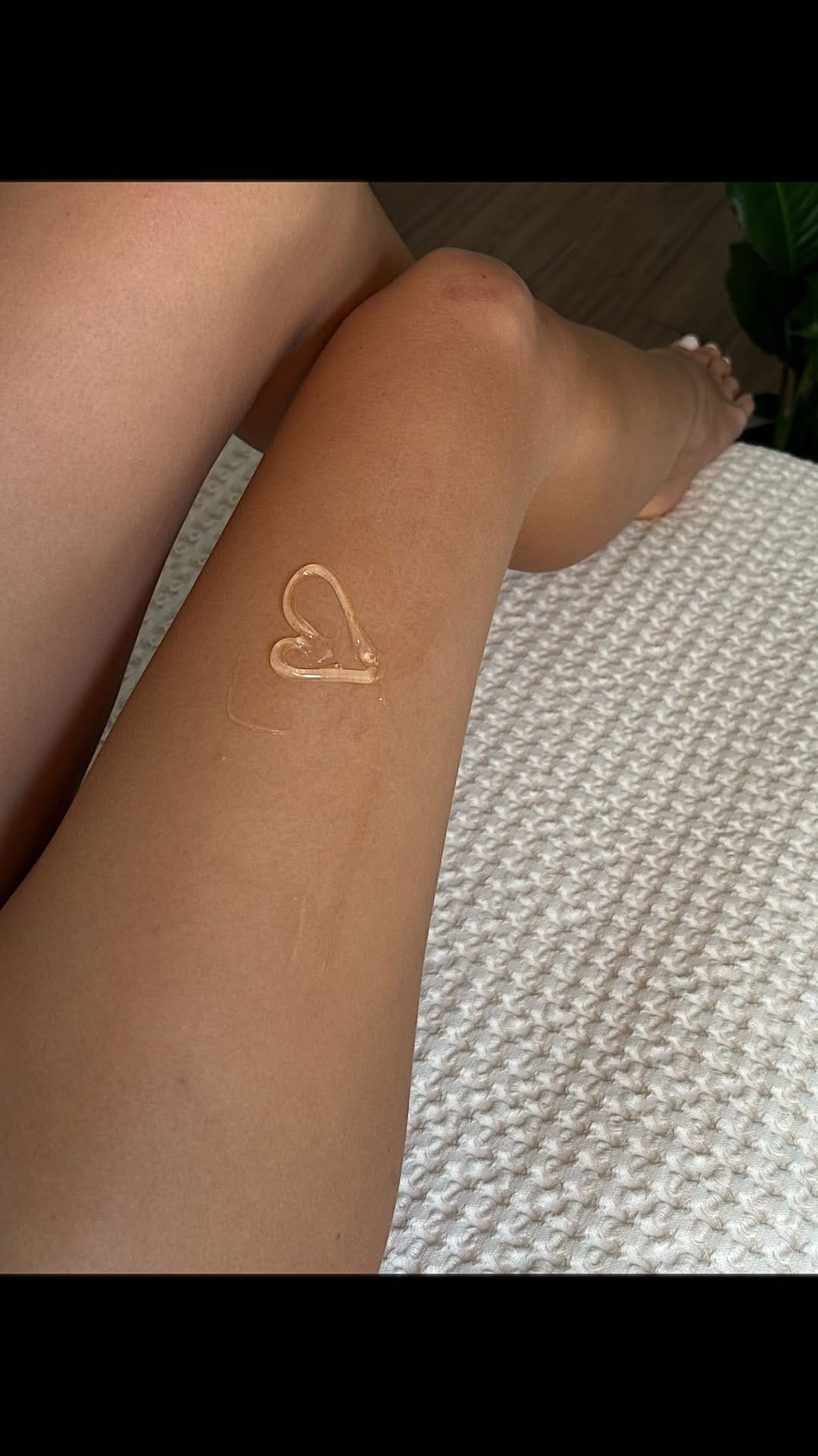 Post 6 by Glownar Aesthetics on Instagram (video)