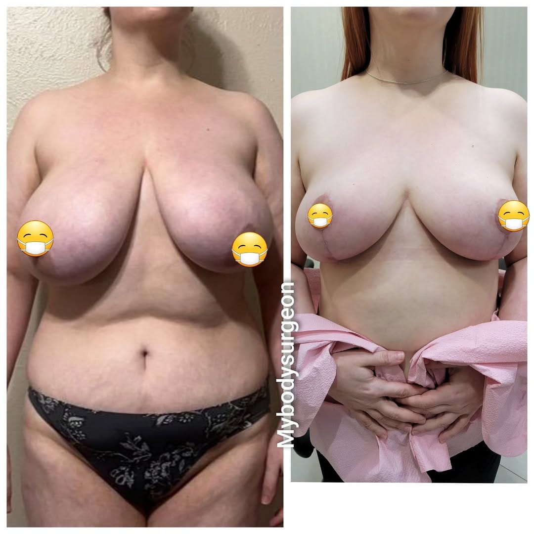 Post 1 by Sugar Land Plastic Surgery / MyBodySurgeon / MyBodySurgeon_htx on Instagram (carousel)