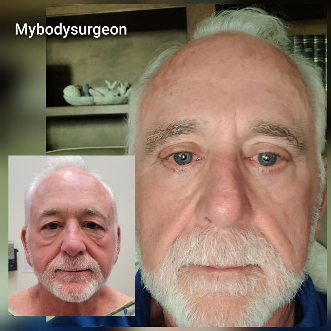 Post 7 by Sugar Land Plastic Surgery / MyBodySurgeon / MyBodySurgeon_htx on Instagram (carousel)
