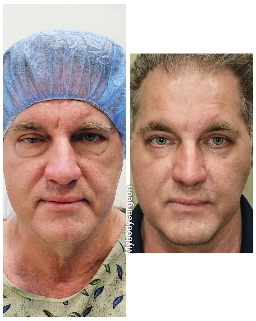 Post 8 by Sugar Land Plastic Surgery / MyBodySurgeon / MyBodySurgeon_htx on Instagram (carousel)