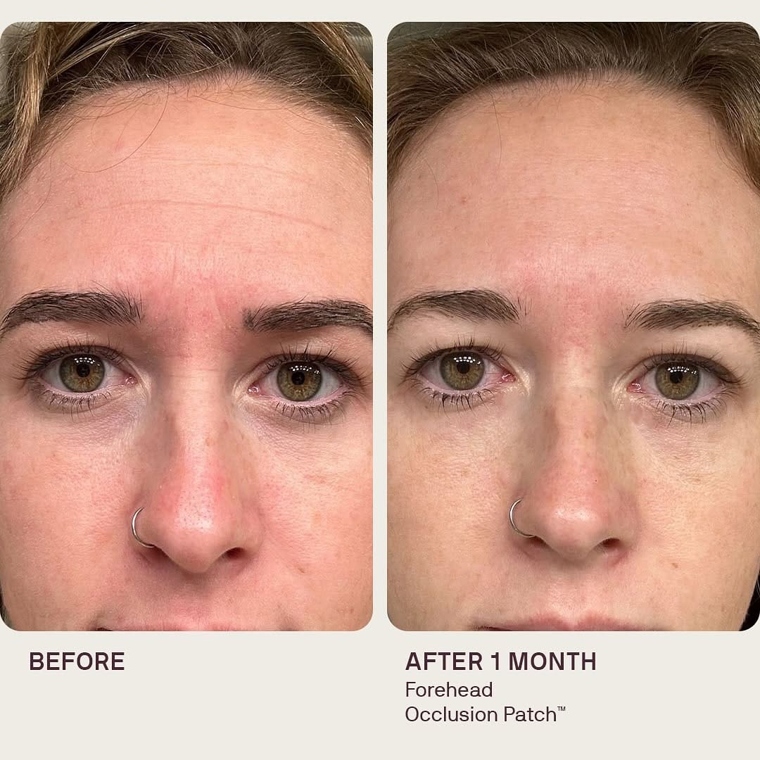 Post 7 by Dermaclara on Instagram (image)