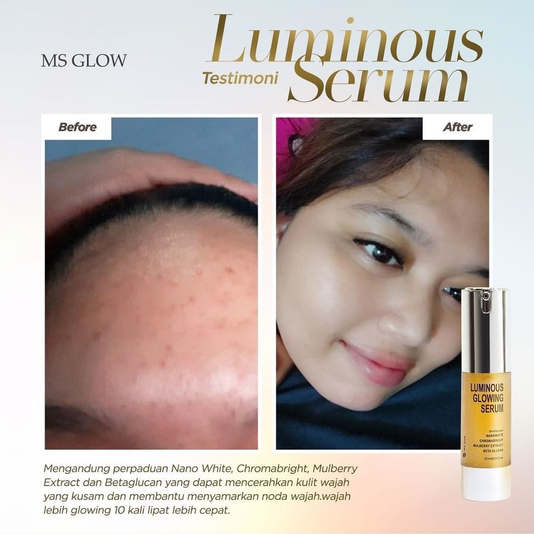 Post 7 by MSGLOW OPEN RESELLER on Instagram (image)