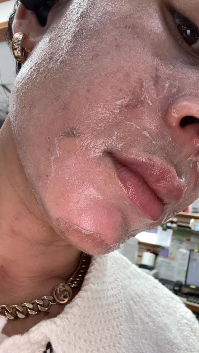 Post 4 by Bleu Spa & Beauty on Instagram (video)