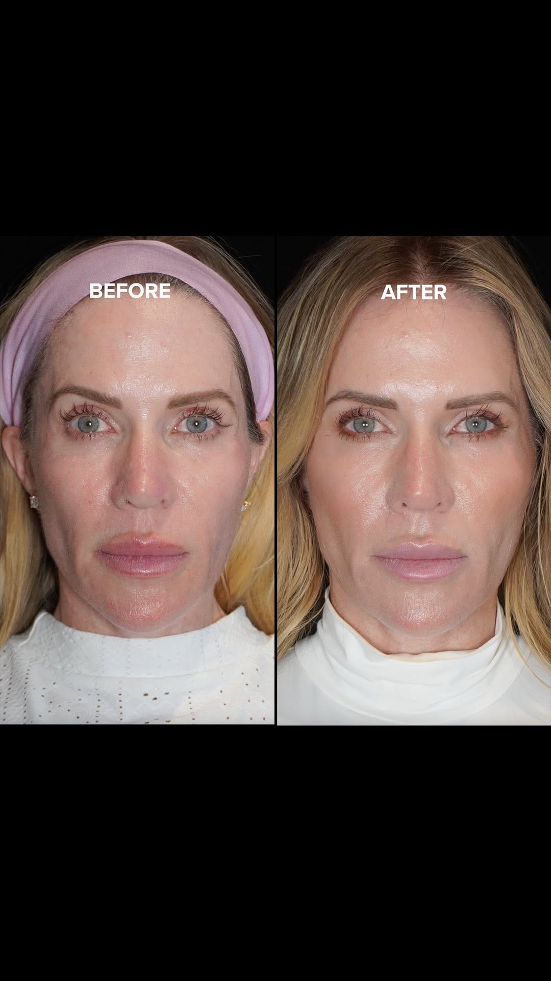 Post 10 by Dr. Jen RHOC 🍊 on Instagram (video)