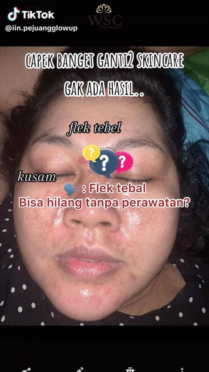 Post 10 by WINDA SKIN CARE on Instagram (video)