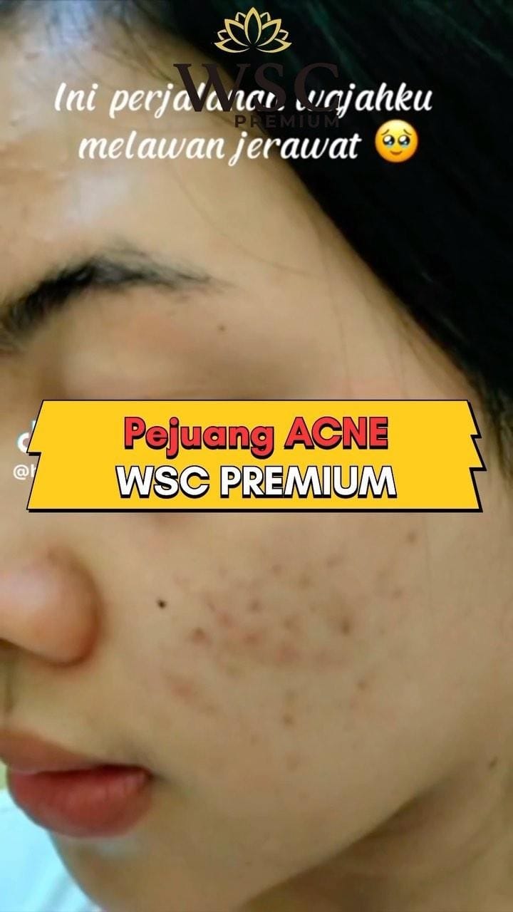Post 9 by WINDA SKIN CARE on Instagram (video)