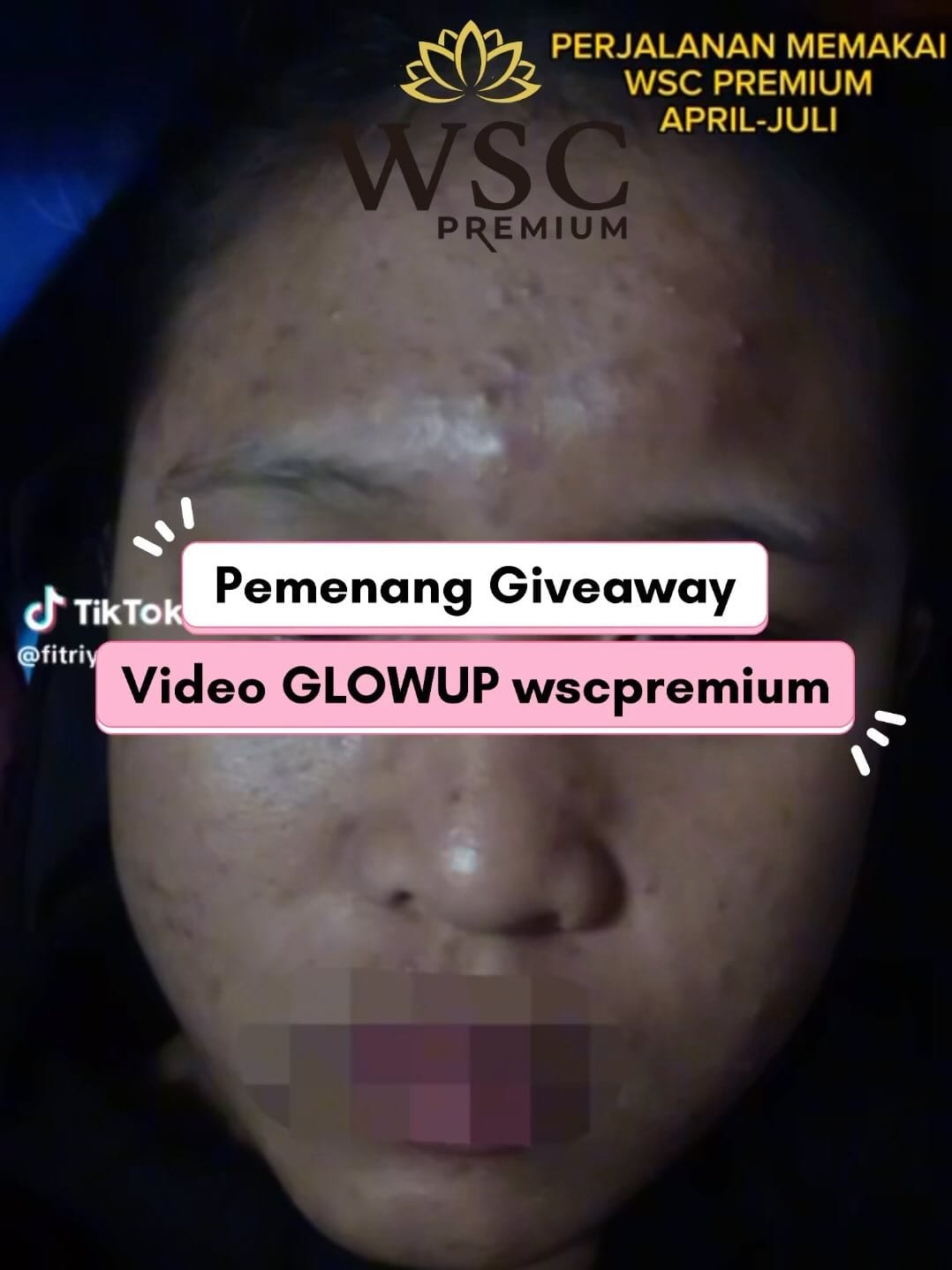 Post 8 by WINDA SKIN CARE on Instagram (video)